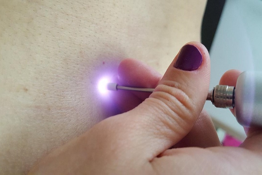 Laser fisioterapia coluna