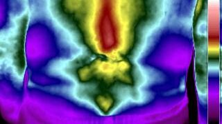 Sobre gradientes e suas peculiaridades 2