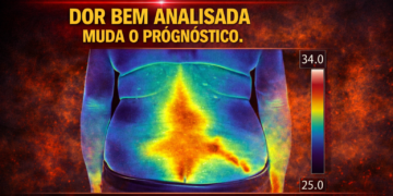 Dor e analgesia – parte 4