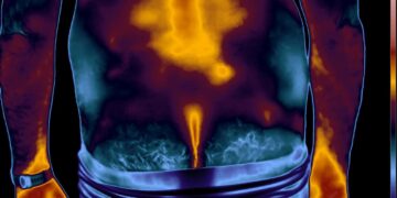 Sobre gradientes e suas peculiaridades – parte 4